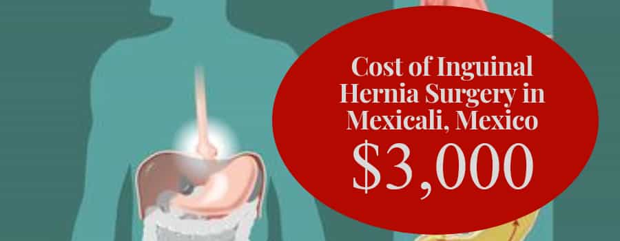 Inguinal Hernia Surgery Cost in Mexicali, Mexico